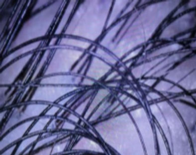Scalp microscopy from RedLight Innovation’s study, participant 01, labelled day 90.