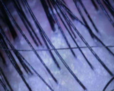 Scalp microscopy from RedLight Innovation’s study, participant 01, labelled day 0.