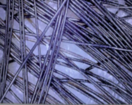 Scalp microscopy from RedLight Innovation’s study, participant 03, labelled day 90.