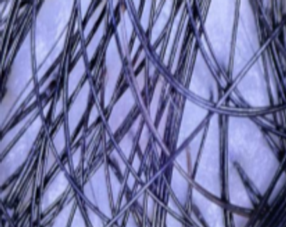 Scalp microscopy from RedLight Innovation’s study, participant 03, labelled day 0.